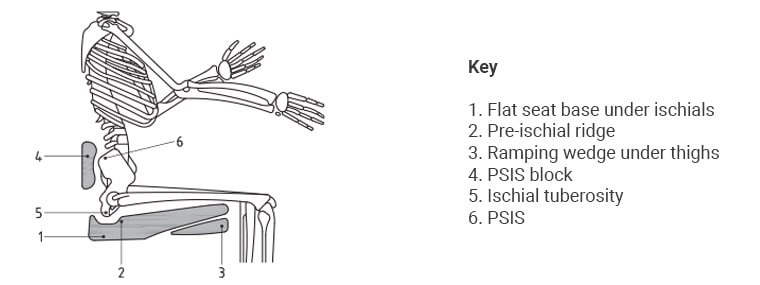 Fig 3 Protecting against posterior tilt