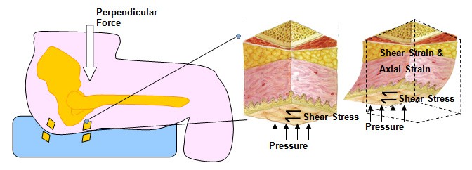 Fig 4 Example of skin deformities